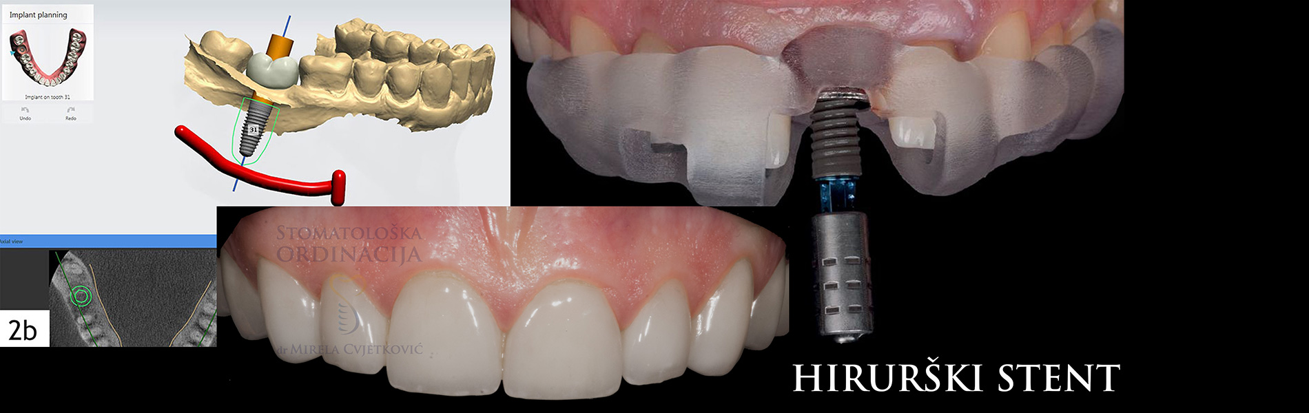 Read more about the article When will I get new teeth?